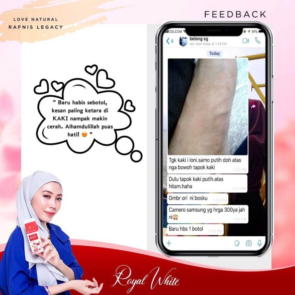 Testimoni Royal White Beauty Baru sebotol dah putih sampai telapak kaki